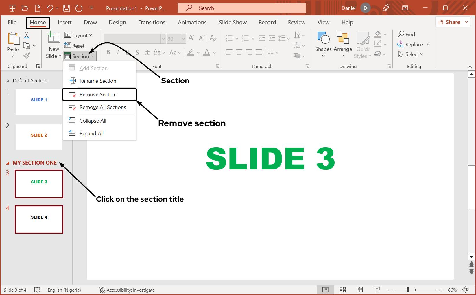 removing-section-alternative